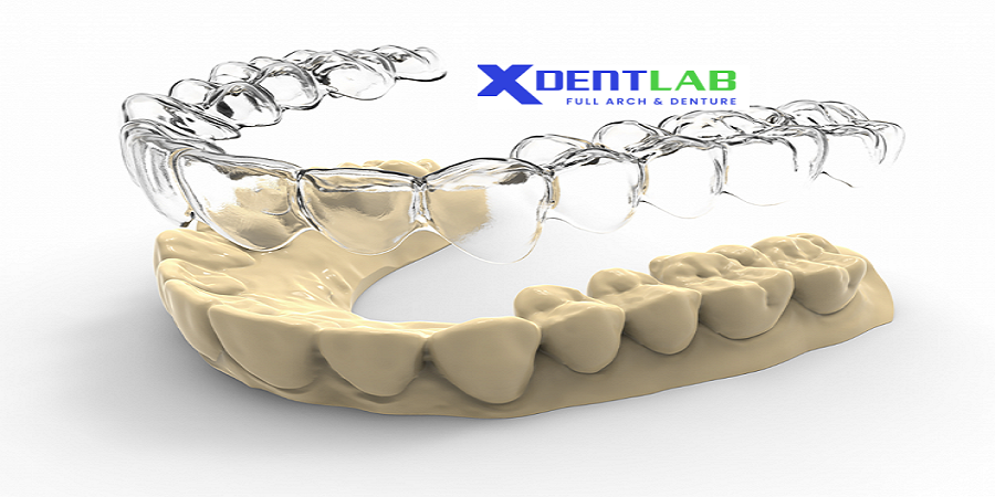 introduce 3D printed aligners