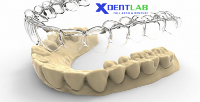 Clear aligner supplier
