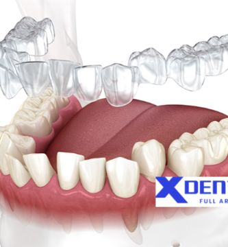 Clear aligner supplier in vietnam