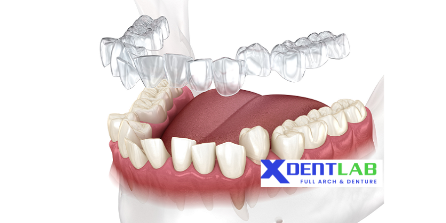 Clear aligner supplier in vietnam