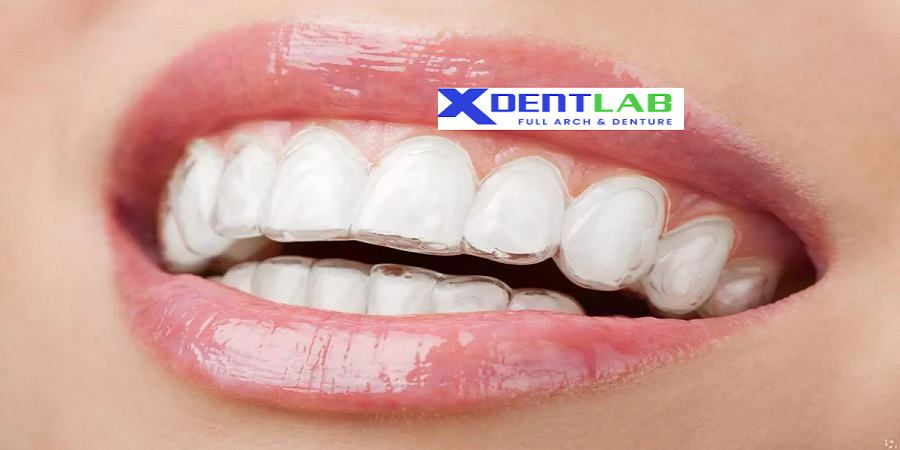 Global contract manufacturing for clear aligners