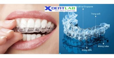 introduce International dental aligner manufacturing