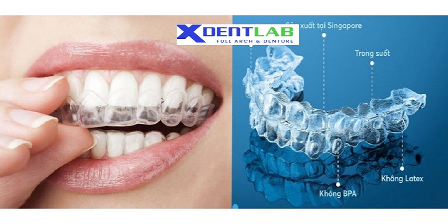 introduce International dental aligner manufacturing