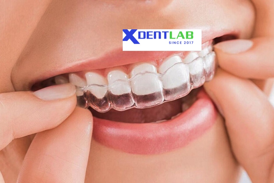 Global Clear Aligner Manufacturers