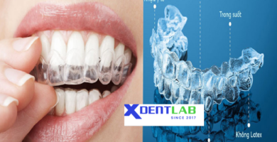 Worldwide clear aligner contract production