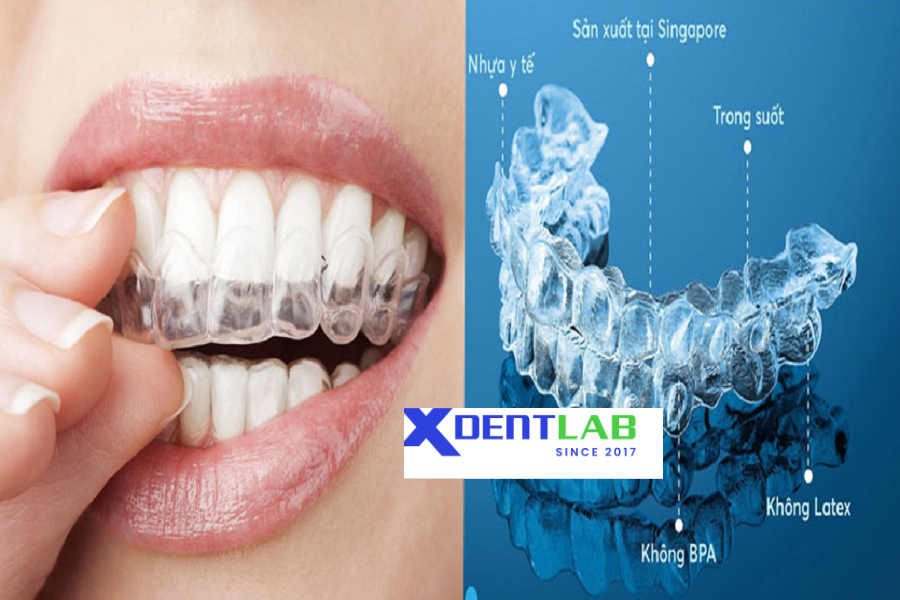 Worldwide clear aligner contract production