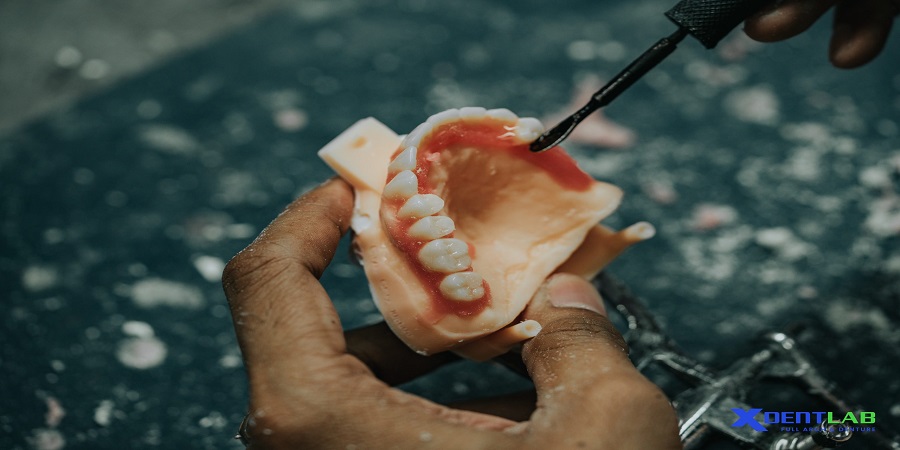 Removable Denture Lab District 10 Ho Chi Minh