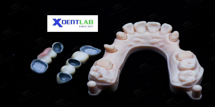 Vietnam Dental Laboratory District 6 Ho Chi Minh