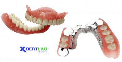 Removable Denture Lab District 8 Ho Chi Minh