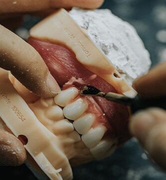Vietnam dental laboratories district 1 Ho Chi Minh