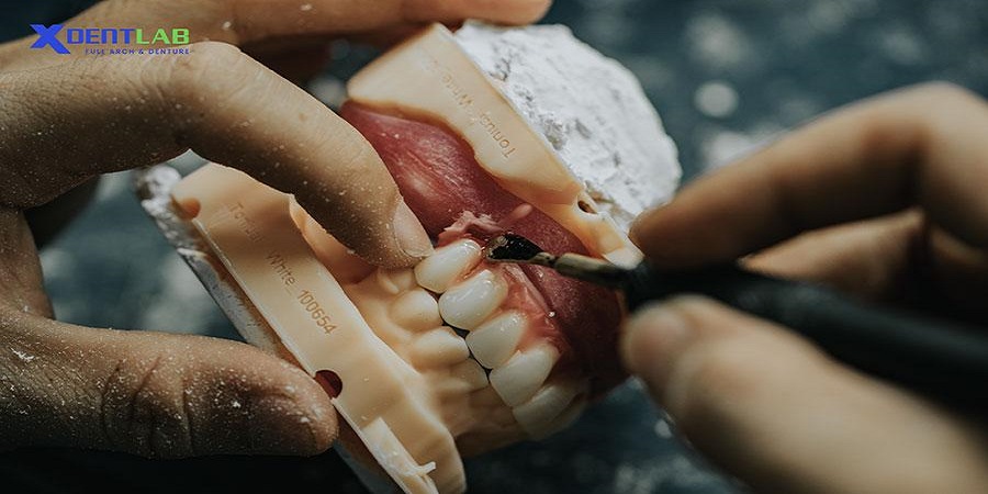 Vietnam dental laboratories district 1 Ho Chi Minh